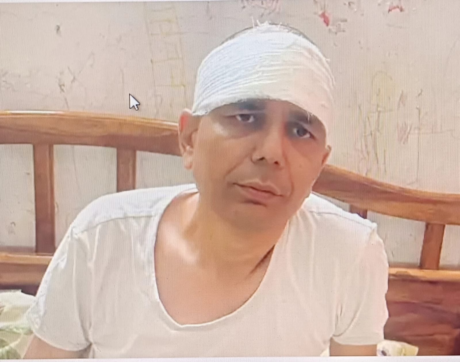 जयपुर में सरकारी अधिकारी पर जानलेवा हमला, 10 दिन बाद भी हमलावर पुलिस की गिरफ्त से बाहर